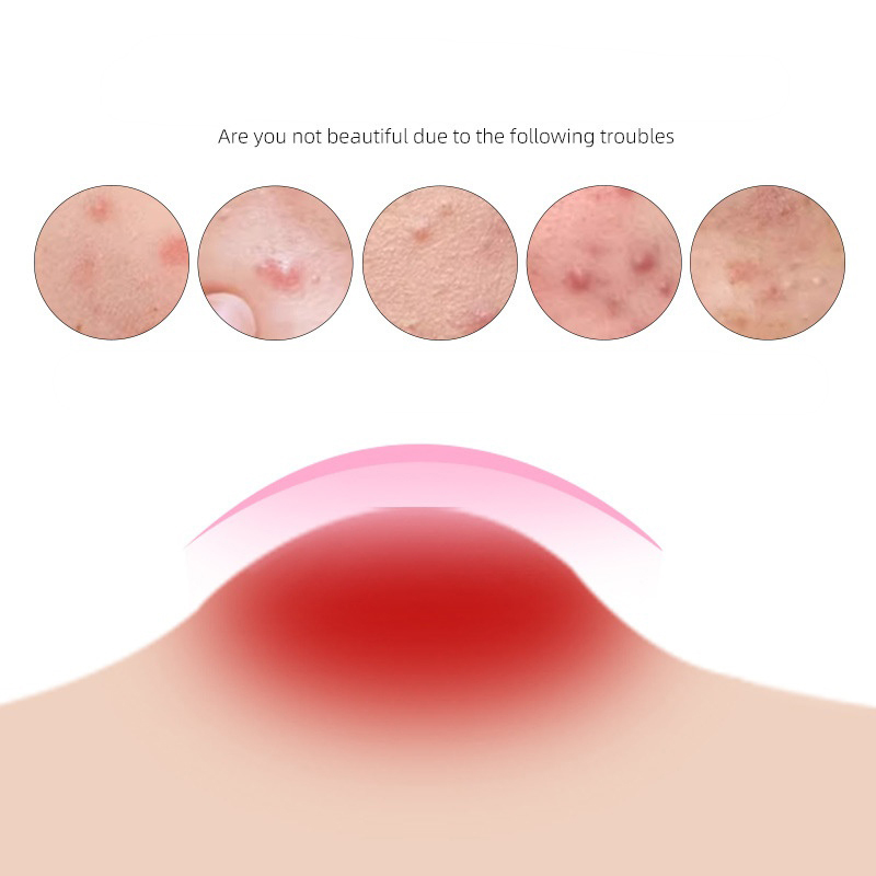 Color Cartoon Acne Patch Skin  - Beauty In Makeup review and price